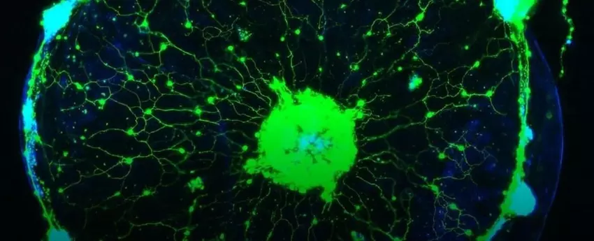 Naukowcy odkryli sposób na czytanie w myślach meduz