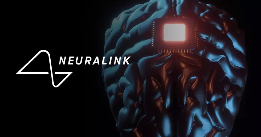 Rozszerzenie programu Neuralink: wolontariusze z całego świata mogą teraz aplikować o wszczepienie innowacyjnego neuroczipa