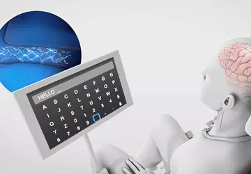 Synchron zintegrował ChatGPT ze swoimi implantami ...