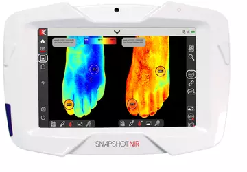 Przenośne urządzenie diagnostyczne "Snapshot NIR" ma ...