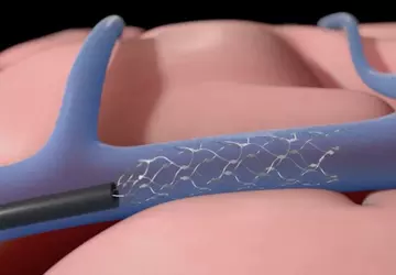 Konkurent Neuralink uzyskał zgodę na badania ...