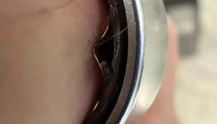 Bateria Galaxy Ring wypełniła się powietrzem na palcu, inteligentny pierścień musiał zostać zdjęty w szpitalu